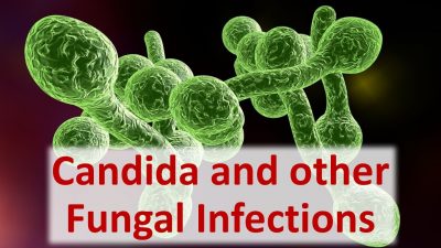 Candida Fungal Infection