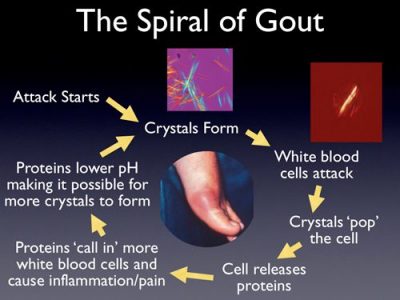 gout effect
